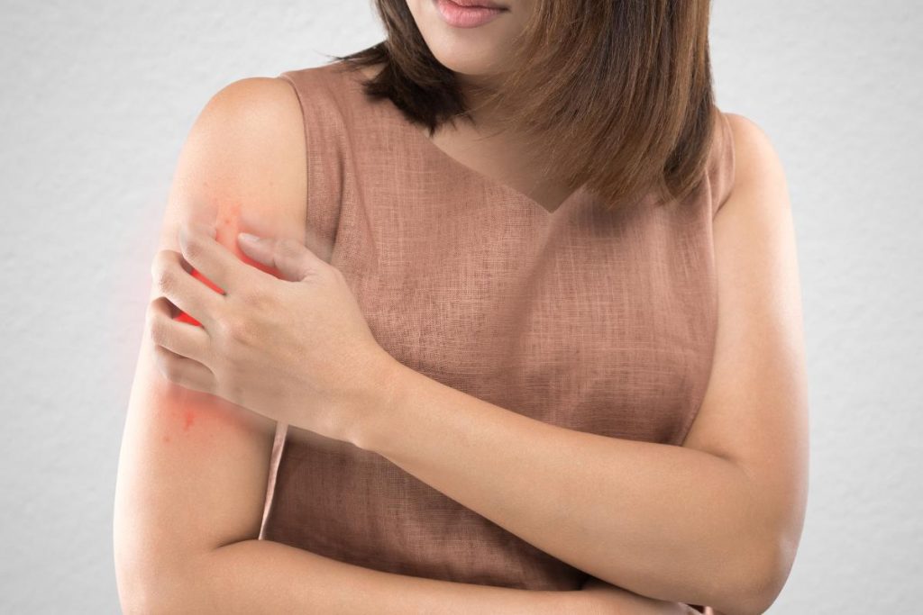 mulher com sintoma de dengue